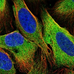 TBC1D4 Antibody, Novus Biologicals 0.1mL; Unlabeled:Antibodies, Polyclonal